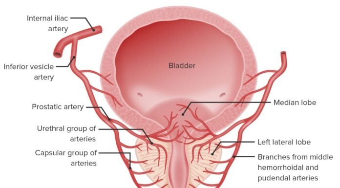 Síndrome de Congestão Pélvica Masculina: Descubra Como as Varizes Periprostáticas Afetam sua Saúde e o Tratamento por Embolização Anatomia vascular do plexo prostático